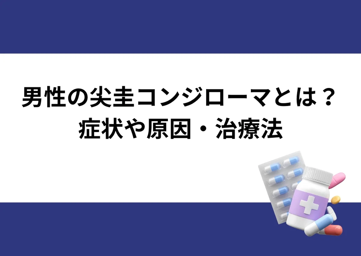 「男性の尖圭コンジローマとは？／症状や原因・治療法」と記載したアイキャッチ｜川崎検査クリニック